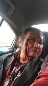 Lagi-lagi Media Jadi Korban Pemukulan Saat Ingin Konfirmasi