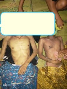 Nahas!!. Dua Orang Warga Kecamatan Cikedal Kabupaten Pandeglang Tewas Tersambar Petir