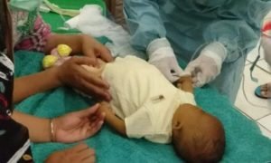 Aisyah Bayi 4,5 Bulan Penderita Kelainan Jantung dan Gagal Hati di Tanggamus Butuh Uluran Tangan