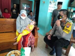 100 Hari Kerja, Kapolres Probolinggo Bantu Anak Penderita Hydrocepalus