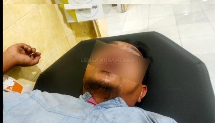 Seorang Warga di Probolinggo Dipukul OTK Hingga Babak Belur