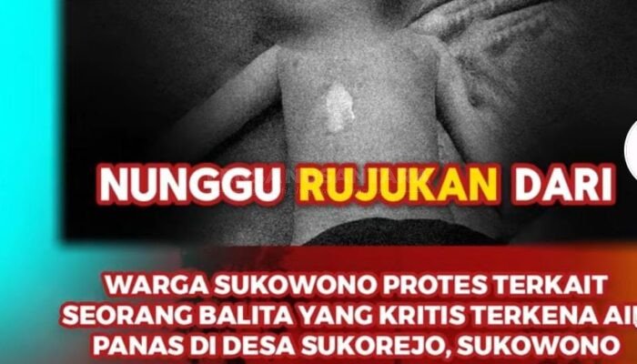 Puskesmas Sukowono di Jember Diduga Larang Antar Balita Terkena Tumpahan Air Panas Gunakan Ambulans Desa