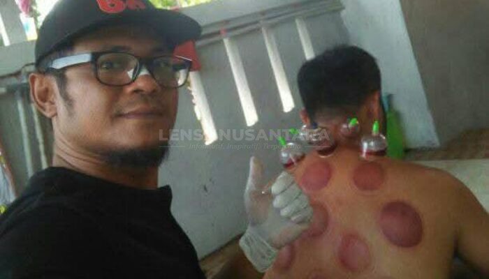 Bekam, Pijat, dan Gurah Kang Juhandi Purwakarta, Solusi Sehat Islamiah