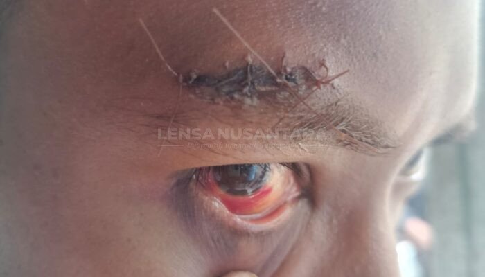 Penjual Tahu Ledokombo Jember Dianiaya Orang Bermobil Hitam Hingga Terluka Parah