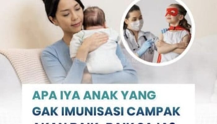 RSUD Pandega Peringatkan Kasus Penyakit Campak Menular